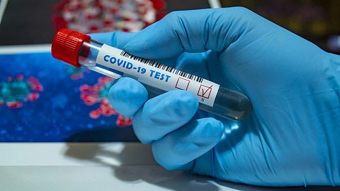 😱У Маріуполі спалах коронавірусної інфекції!
🦠У Маріуполі зафіксували зростання захворюваності на гострі... 😱У Маріуполі спалах коронавірусної інфекції!
🦠У Маріуполі зафіксували зростання захворюваності на гострі...