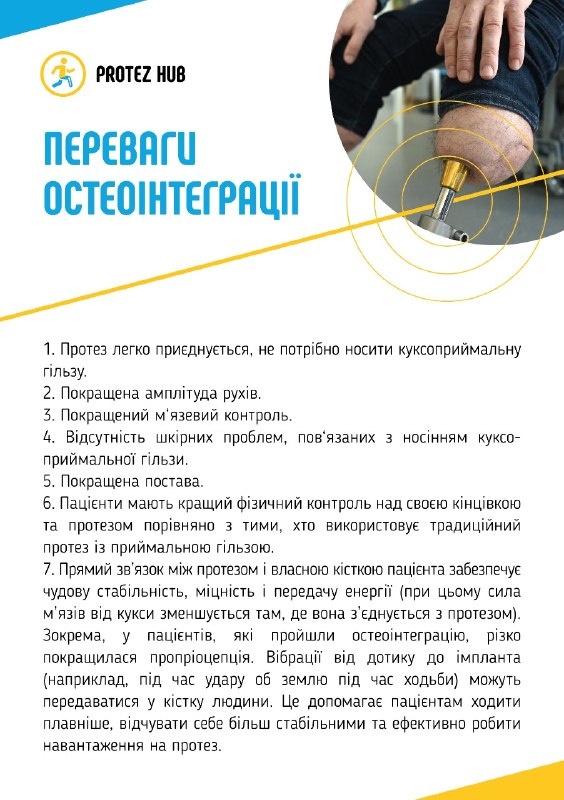 Остеоінтеграція в Україні — переваги та ризики сучасного методу протезування 🦿 Остеоінтеграція в Україні — переваги та ризики сучасного методу протезування 🦿