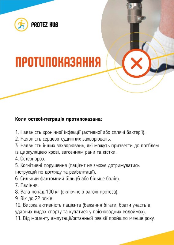 Остеоінтеграція в Україні — переваги та ризики сучасного методу протезування 🦿 Остеоінтеграція в Україні — переваги та ризики сучасного методу протезування 🦿