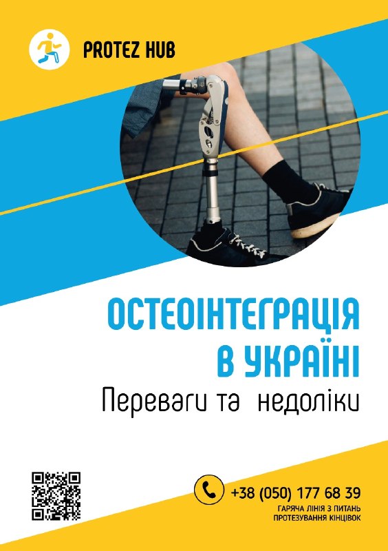 Остеоінтеграція в Україні — переваги та ризики сучасного методу протезування 🦿 Остеоінтеграція в Україні — переваги та ризики сучасного методу протезування 🦿
